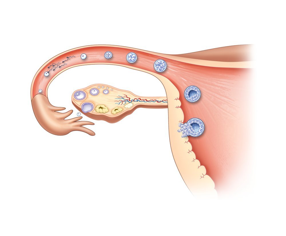 다낭성 난소 증후군 미성숙 난포를 이용한 임신 2